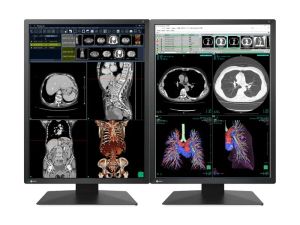 Medical Monitor EIZO Radi Force RX270 - 21.3" inch, 2MP Color LED