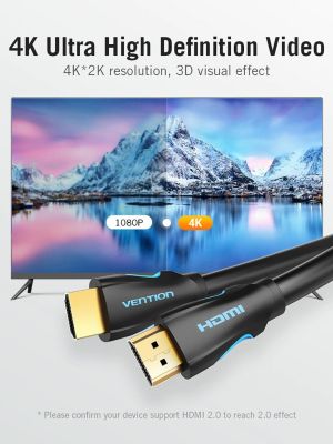 Cablu Vention Cablu HDMI 2.0 15.0m - 4K/60Hz Negru - VAA-M02-B1500